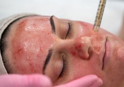majestic-spa-face-033